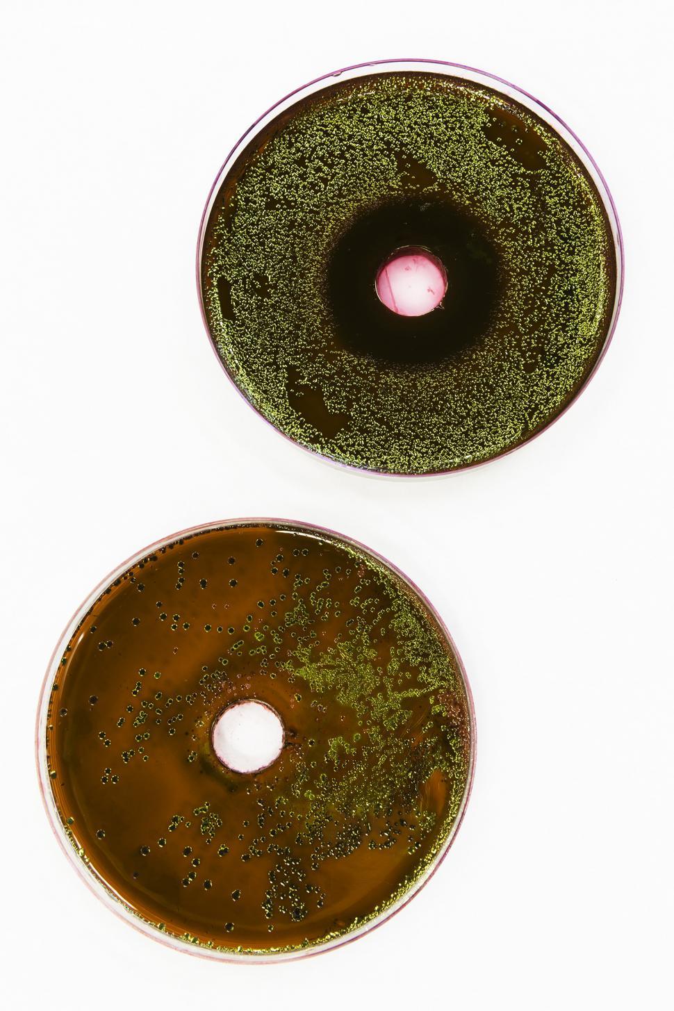 Free Image of E. coli 