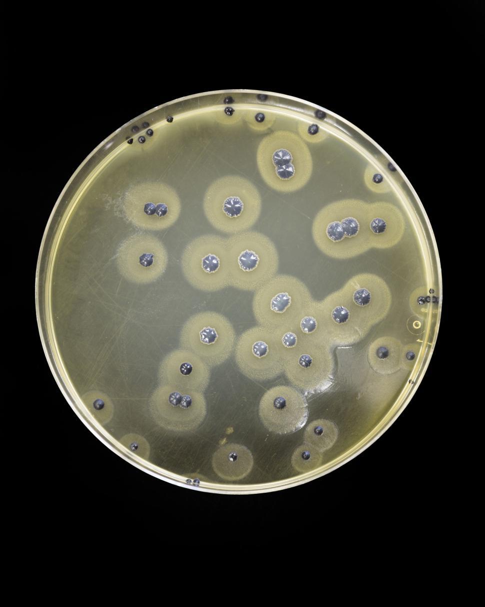 Download Free Stock Photo of Staphylococcus aureus  