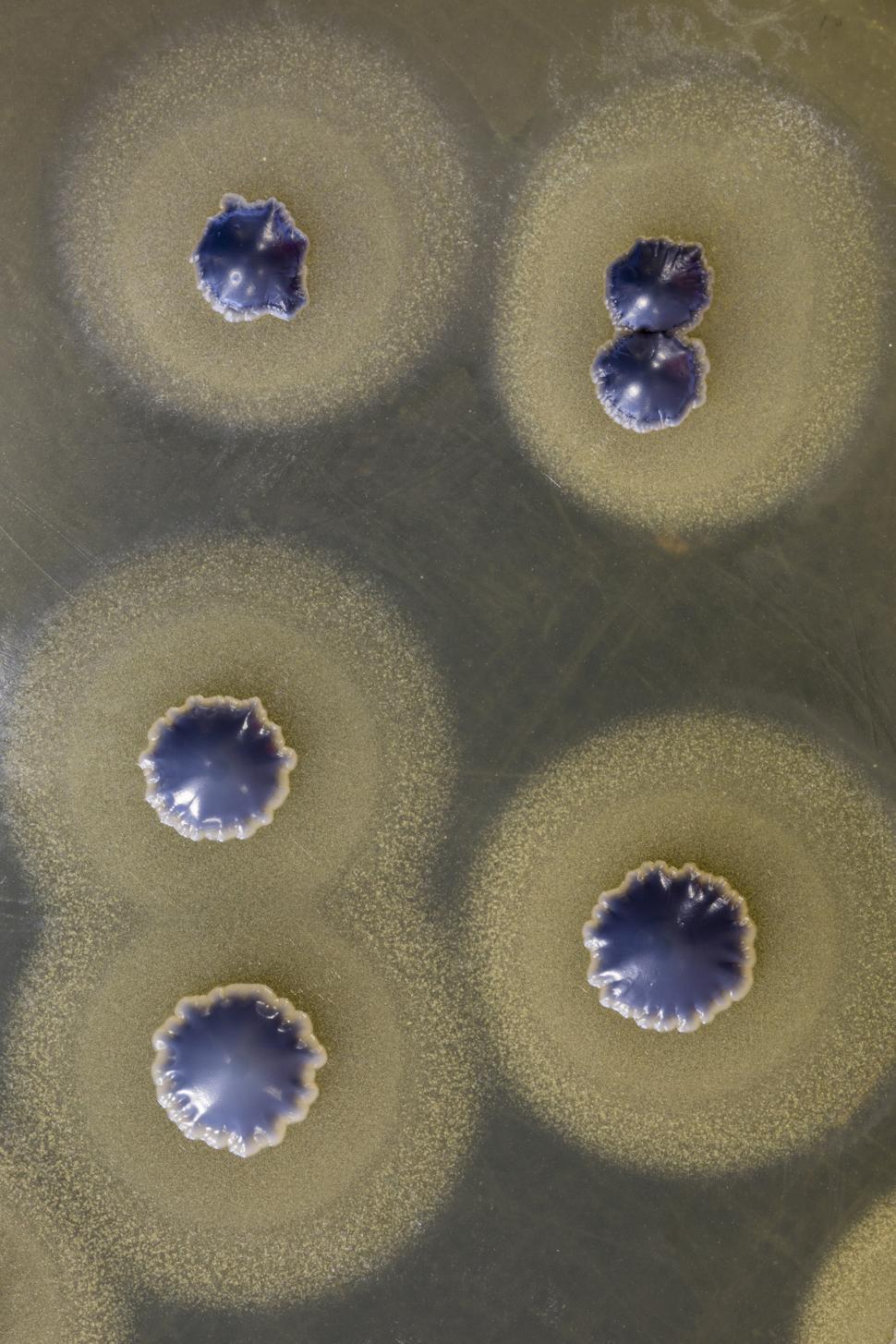 Free Image of Macro of  Staphylococcus aureus  