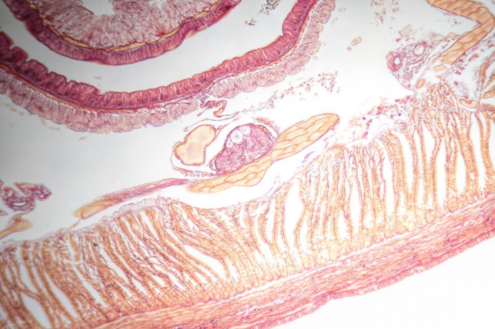Free Image of Earthworm stained cross section 