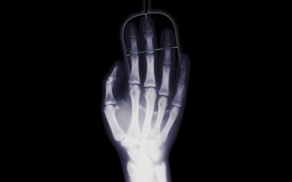 Free Image of Hand Holding Light Bulb X-Ray 
