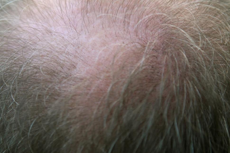 Free Image of Man With a Full Head of Hair 