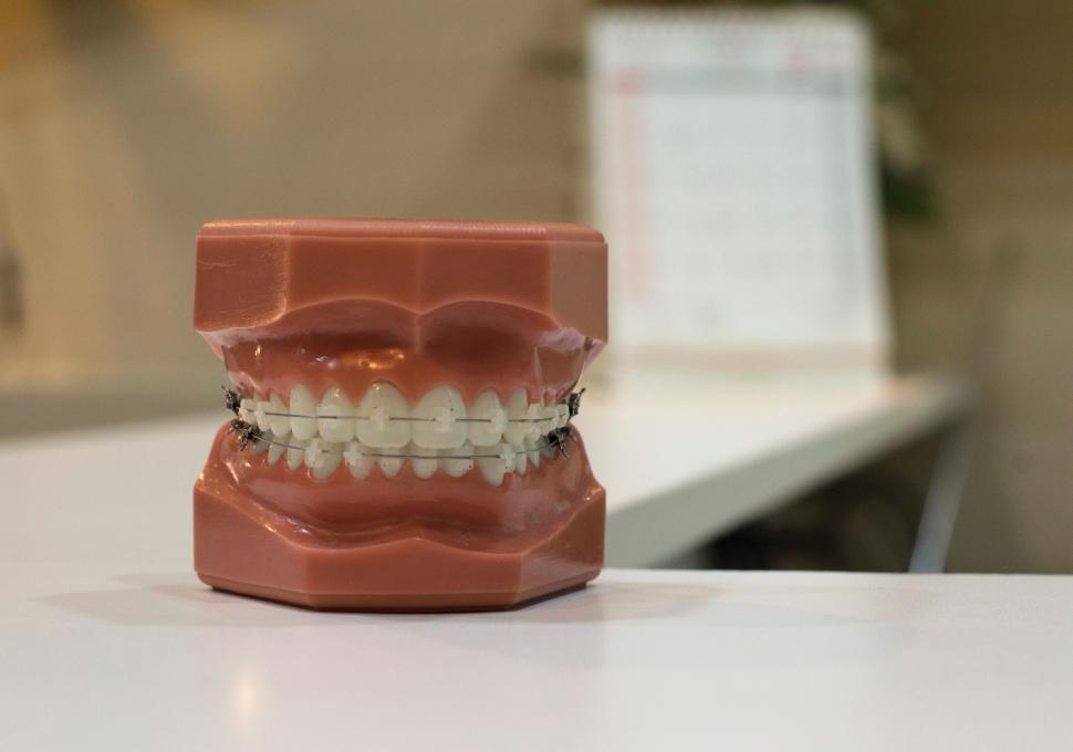 Free Image of Plastic Model of Teeth With Braces 